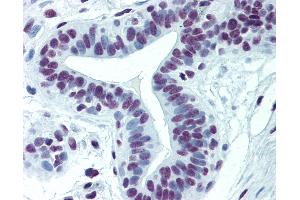 anti-Cyclin-Dependent Kinase-Like 1 (CDC2-Related Kinase) (CDKL1) (AA 259-358) antibody