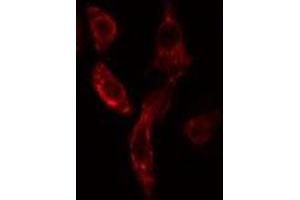 ABIN6275886 staining COLO205 cells by IF/ICC. (VASH1 anticorps  (Internal Region))