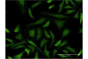 Immunofluorescence of monoclonal antibody to GAS2L3 on HeLa cell. (GAS2L3 anticorps  (AA 595-694))
