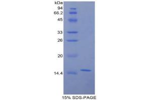 SDS-PAGE analysis of Rat Galactosylceramidase Protein.