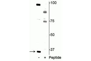 Western blot of jurkat cell lysate showing specific immunolabeling of the ~34 kDa REDD1 protein phosphorylated at Thr23/25 in the first lane (-). (DDIT4 anticorps  (pThr23, pThr25))