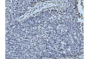 IHC analysis of MRE11 using anti-MRE11 antibody (ABIN7600025). (Mre11 anticorps  (AA 14-481))