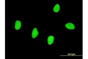 Immunofluorescence of monoclonal antibody to RBMS2 on HeLa cell. (RBMS2 anticorps  (AA 308-407))