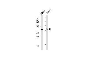 Western blot analysis of lysates from Hela,Daudi cell line (from left to right),using CREB3L4 Antibody (monoclonal) (M01) (ABIN1882056 and ABIN2838484). (USF1 anticorps  (AA 1-310))