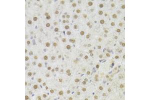 Immunohistochemistry of paraffin-embedded rat liver using HDGF Antibody (ABIN1876535) at dilution of 1:100 (40x lens). (HDGF anticorps)