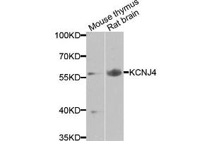 Western blot analysis of extracts of various cells, using KCNJ4 antibody. (KCNJ4 anticorps)