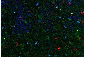 Image no. 1 for anti-Interleukin 11 (IL11) antibody (ABIN465009) (IL-11 anticorps)