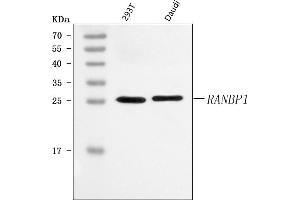 Western blot analysis of RANBP1 using anti-RANBP1 antibody (ABIN7602058).