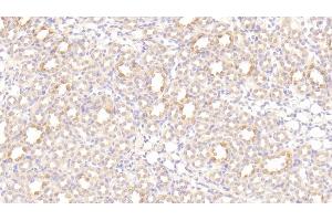 Detection of LEPR in Rat Kidney Tissue using Polyclonal Antibody to Leptin Receptor (LEPR)