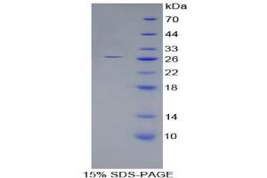 SDS-PAGE analysis of Human Nephrin Protein.