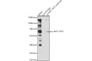 Immunoprecipitation analysis of 200 μg extracts of Jurkat cells, using 3 μg Phospho--S473 pAb (ABIN1513328, ABIN5664973, ABIN5664975 and ABIN6225474). (AKT1 anticorps  (pSer473))