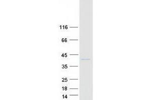 Validation with Western Blot