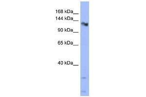 WB Suggested Anti-CHERP Antibody Titration:  0. (CHERP anticorps  (Middle Region))