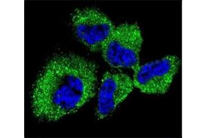Confocal immunofluorescent analysis of PGP9.