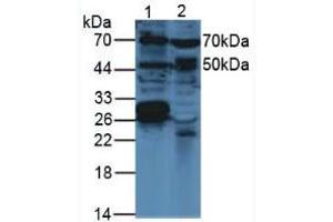Western blot analysis of (1) Mouse Brain Tissue and (2) Mouse Breast Tissue. (VEGFC anticorps  (AA 108-223))