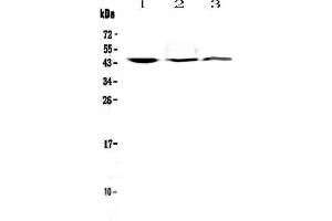 Western blot analysis of CD16 using anti-CD16 antibody . (FCGR3A anticorps  (AA 101-166))