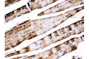 CA3 was detected in paraffin-embedded sections of rat skeletal muscle tissues using rabbit anti- CA3 Antigen Affinity purified polyclonal antibody (Catalog # ) at 1 ?