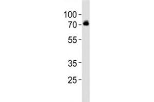 Western blot analysis of lysate from SH-SY5Y cell line using DBH antibody at 1:1000.