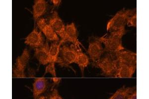 Immunofluorescence analysis of C6 cells using SNX15 Polyclonal Antibody at dilution of 1:100. (SNX15 anticorps)
