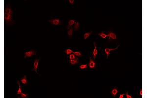 ABIN6269210 staining A549 cells by IF/ICC. (MARCKS anticorps  (Internal Region))