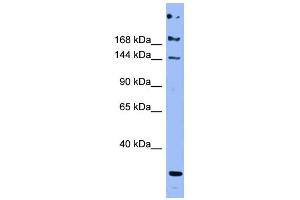 WB Suggested Anti-APOB Antibody Titration:  0. (APOB anticorps  (Middle Region))