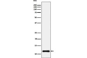 Western blot analysis of NDUFC2 expression in HeLa cell lysate.