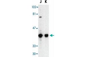Western blot analysis of DFFB in Jurkat (J) and K-562 (K) whole cell lysate with DFFB polyclonal antibody  at 1 : 500 dilution. (DFFB anticorps  (AA 3-18))