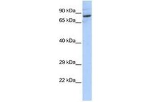 Image no. 1 for anti-serine Palmitoyltransferase, Long Chain Base Subunit 2 (SPTLC2) (AA 72-121) antibody (ABIN6741036) (SPTLC2 anticorps  (AA 72-121))