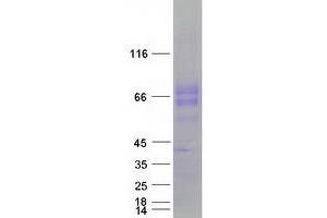 Validation with Western Blot
