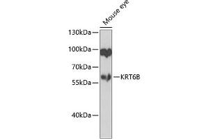 Western blot analysis of extracts of mouse eye, using KRT6B antibody (ABIN6129538, ABIN6143035, ABIN6143036 and ABIN6223626) at 1:1000 dilution.