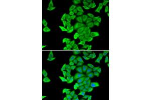 Immunofluorescence analysis of HeLa cells using SMYD2 antibody. (SMYD2A anticorps)