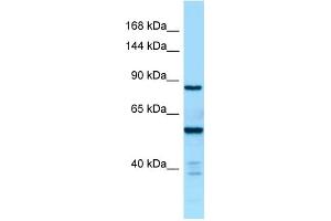 WB Suggested Anti-CTDP1 Antibody Titration: 1. (CTDP1 anticorps  (C-Term))