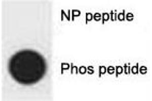 Dot blot analysis of p-p62 antibody.