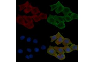 ABIN6257255 and ABIN6274428 staining Hela cells(24h of starvation treatment) by IF/ICC. (HIPK4 anticorps  (C-Term))