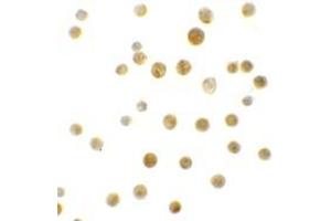 Immunohistochemistry (IHC) image for anti-B-Cell CLL/lymphoma 9-Like (BCL9L) (N-Term) antibody (ABIN1031268)