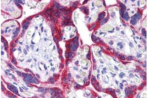 Human Placenta: Formalin-Fixed, Paraffin-Embedded (FFPE) (ATG9B anticorps  (C-Term))