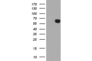 Western Blotting (WB) image for anti-Phosphoribosyl Pyrophosphate Amidotransferase (PPAT) (AA 42-278) antibody (ABIN1491503) (PPAT anticorps  (AA 42-278))
