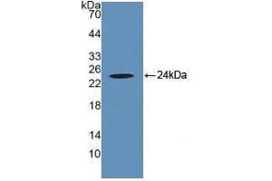 Western blot analysis of recombinant Human CRYaB. (CRYAB anticorps  (AA 1-175))