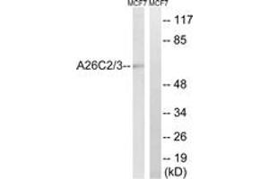 Western blot analysis of extracts from MCF-7 cells, using A26C2/3 Antibody. (A26C2/3 (AA 178-227) anticorps)