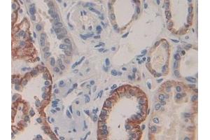 Detection of CDH16 in Human Kidney Tissue using Polyclonal Antibody to Cadherin 16 (CDH16)