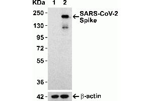 Overexpression Validation in Spike Transfected 293 Cells Loading: 10 μg per lane of 293 cell lysate. (SARS-CoV-2 Spike anticorps)