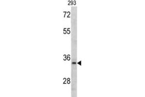 Western Blotting (WB) image for anti-DNA Segment, MCA1, Multiple CA Repeat 1 (MCA1) antibody (ABIN3002773) (MCA1 anticorps)