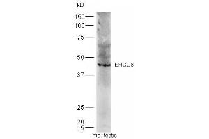 Mouse testis lysates probed with Rabbit Anti-ERCC*/CSA Polyclonal Antibody, Unconjugated (ABIN1713778) at 1:300 overnight at 4 °C. (ERCC8 anticorps  (AA 161-260))