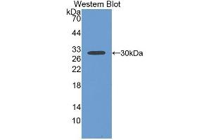 Western Blotting (WB) image for anti-Fibulin 1 (FBLN1) (AA 176-398) antibody (ABIN1175702) (Fibulin 1 anticorps  (AA 176-398))
