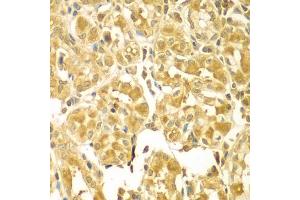 Immunohistochemistry of paraffin-embedded human gastric using SESN2 antibody (ABIN5975589) at dilution of 1/100 (40x lens). (Sestrin 2 anticorps)