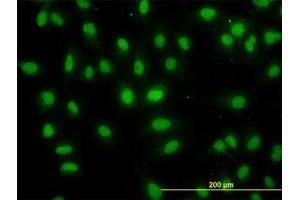 Image no. 5 for anti-DEAD (Asp-Glu-Ala-Asp) Box Polypeptide 56 (DDX56) (AA 450-548) antibody (ABIN599259) (DDX56 anticorps  (AA 450-548))