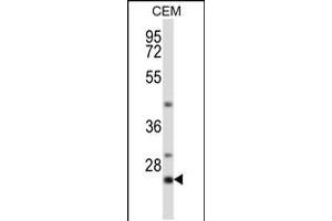 Western blot analysis in CEM cell line lysates (35ug/lane). (LIME anticorps  (C-Term))