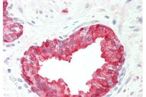 Rabbit Anti-PHGDH antibody Catalog Number: ARP54801 Formalin Fixed Paraffin Embedded Tissue: Human Prostate Primary antibody Concentration: 1:100 Secondary Antibody: Donkey anti-Rabbit-Cy3 Secondary Antibody Concentration: 1:200 Magnification: 20x Exposure Time: 0.