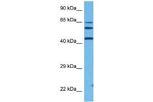 Host:  Rabbit  Target Name:  FOS  Sample Tissue:  Human DLD1 Whole Cell  Antibody Dilution:  1ug/ml (c-FOS anticorps  (Middle Region))