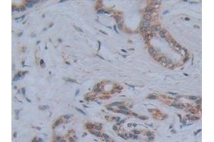 Detection of ALPL in Human Pancreas Tissue using Polyclonal Antibody to Alkaline Phosphatase, Tissue-nonspecific (ALPL)